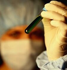 как провериться на паразитов