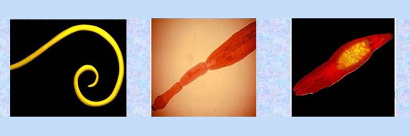 Виды паразитов в организме человека круглые черви, ленточные черви, трематоды